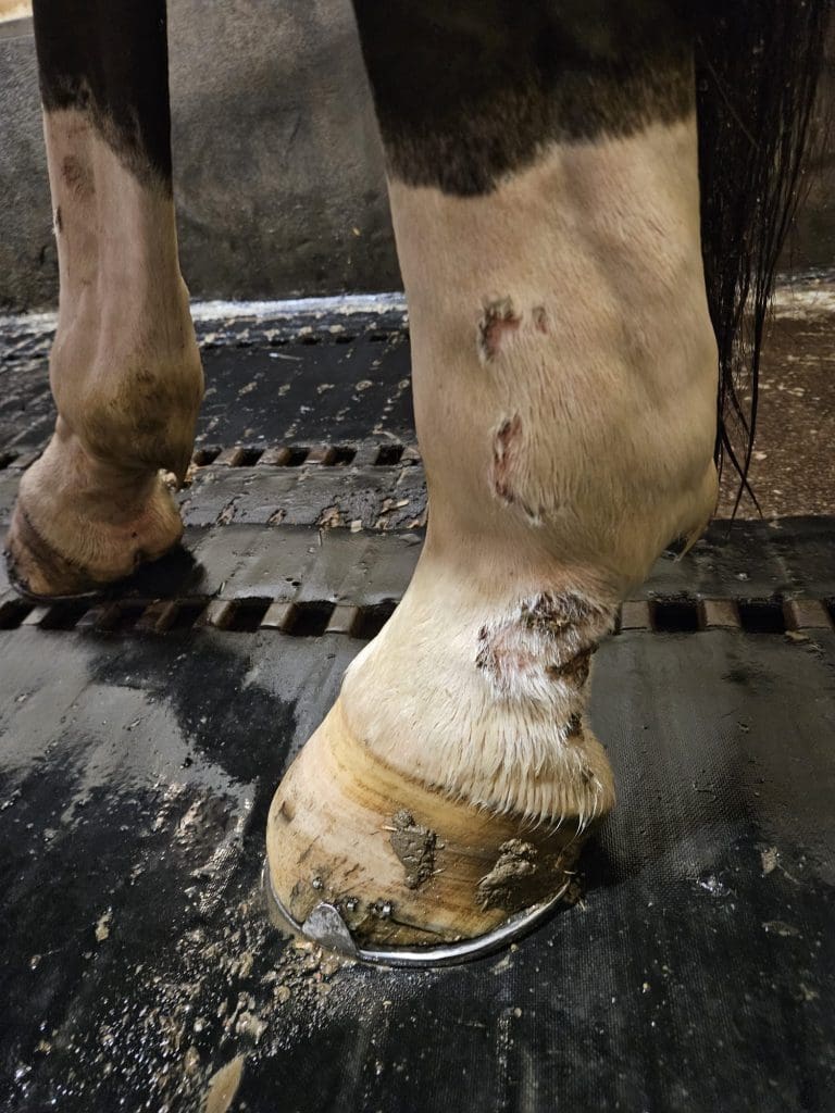 B-cure laser jalkahaava auki